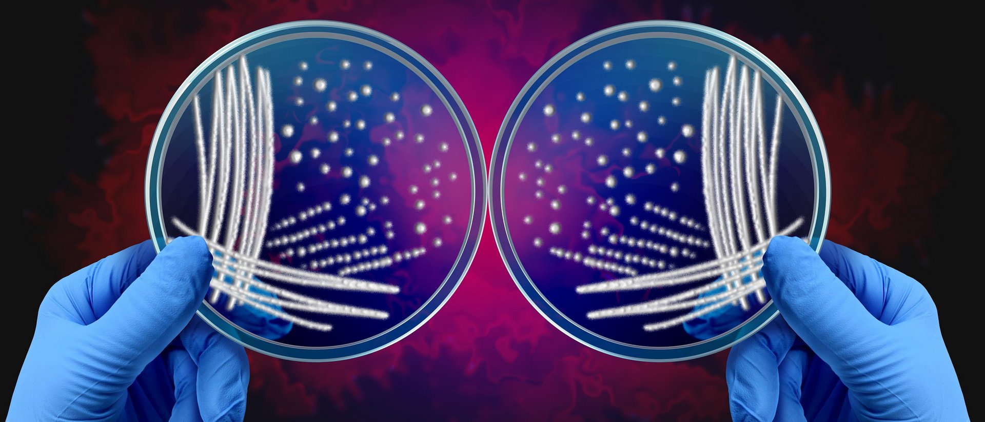 A right hand and a left hand wearing protective gloves each hold a Petri dish on which bacterial colonies are growing.