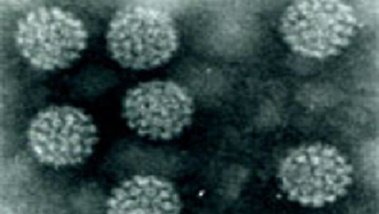 Elektronenmikroskopische Aufnahme von Papillomavirus-Partikeln