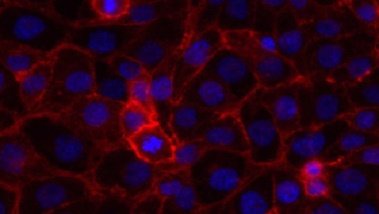 Zellrasen mit DAPI-Färbung des Zellkerns und rot fluoreszierender Zellmembran